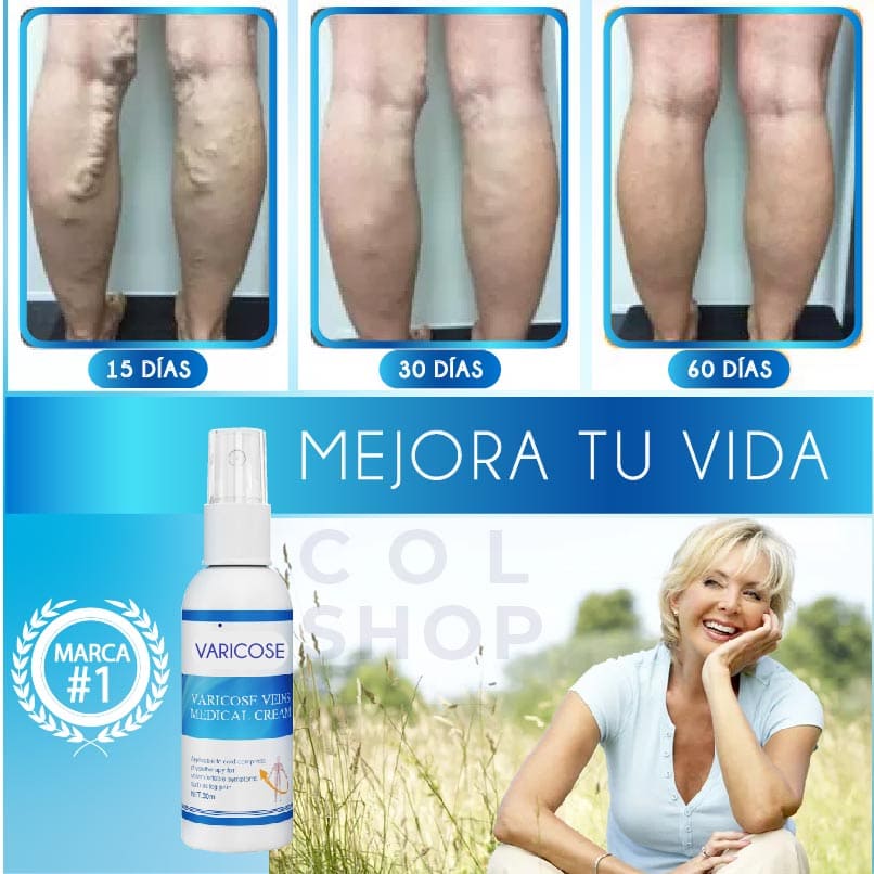 ¡NUEVO! SPRAY ANTI VARICES VEIN PRO® | ⭐⭐⭐⭐⭐