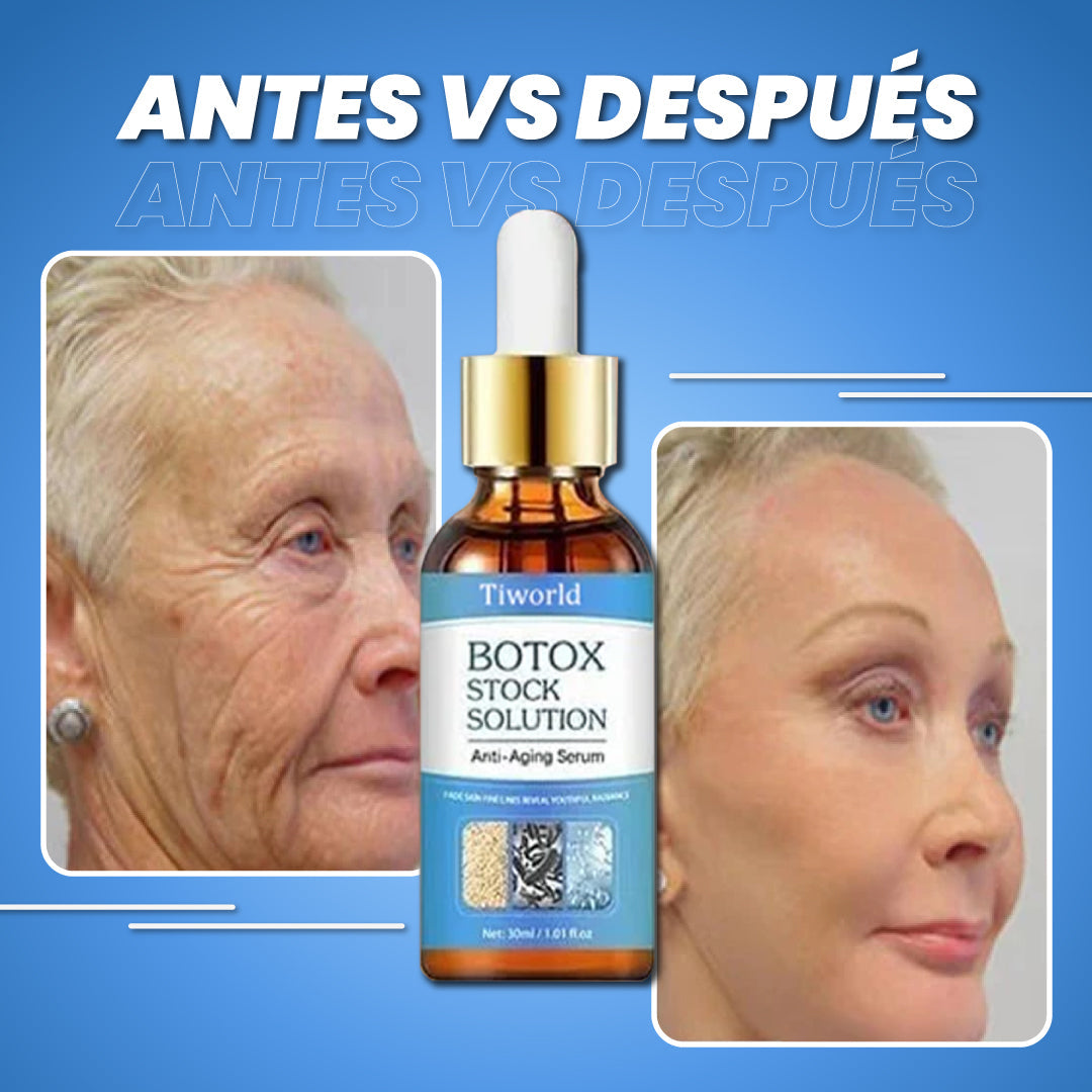 Botox facial para arrugas - Bot Solution™